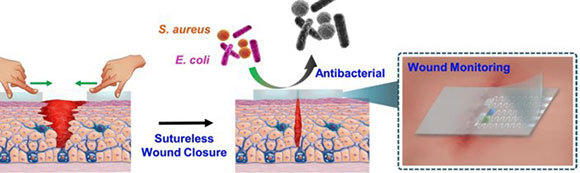 דיאגרמה המראה את דרך עבודתו של הפלסטר החכם | אתר הטכניו