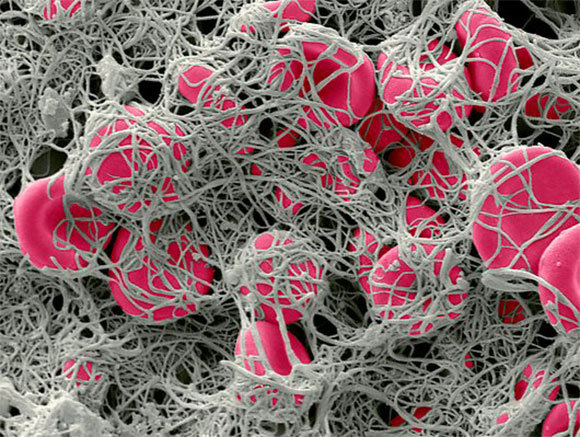 תמונה ממיקרוסקופ אלקטרונים סורק | Steve Gschmeissner, Science Photo Library