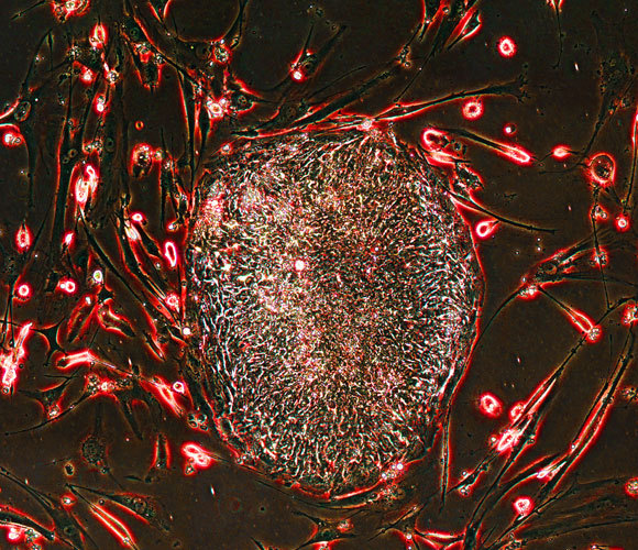 תא גזע מושרה במעבדה באוניברסיטת וויסקונסין-מדיסון | Science Source, SPL