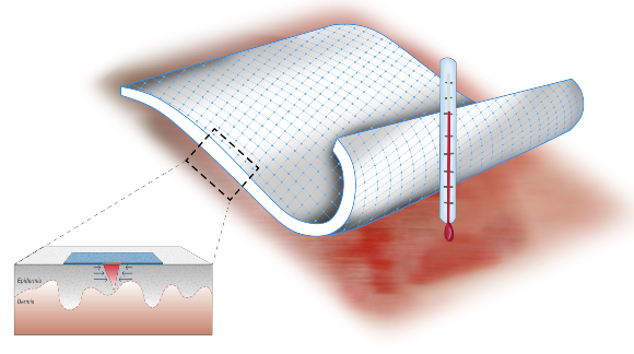 החבישה מתכווצת בחום העור, סוגרת את הפצע ומזרזת את האיחוי | איור: Wyss Institute at Harvard University