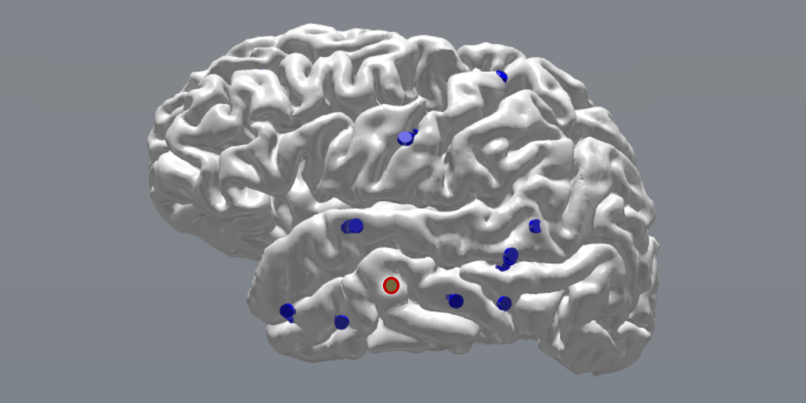 הפעילות החשמלית משפרת זיכרון. נקודות הגירוי בקליפת המוח הצדית-רקתית | איור: יוסף אזיאט, אוניברסיטת פנסילבניה