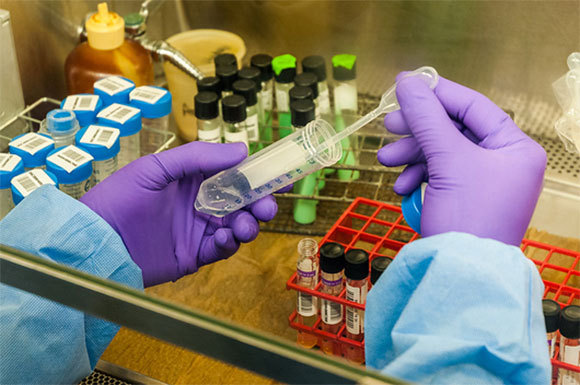 חוקר מכין חיידקי שחפת לניסוי במעבדה בג'ורג'יה, ארה"ב | Richard J. Green, Science Photo Library