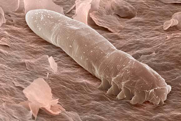 צילום מיקרוסקופ אלקטרונים של דמודקס | Power and Syred, SPL