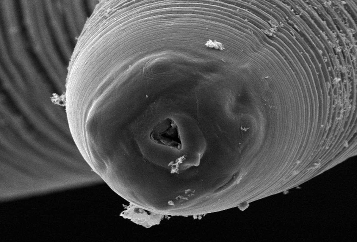 צילום מיקרוסקופ אלקטרונים של אניסאקיס | Science Source, SPL