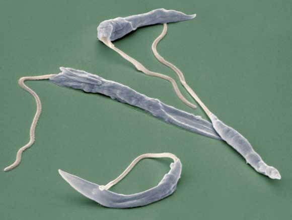 צילום מיקרוסקופ אלקטרונים של טפילי לישמניה | Eye of Science, SPL