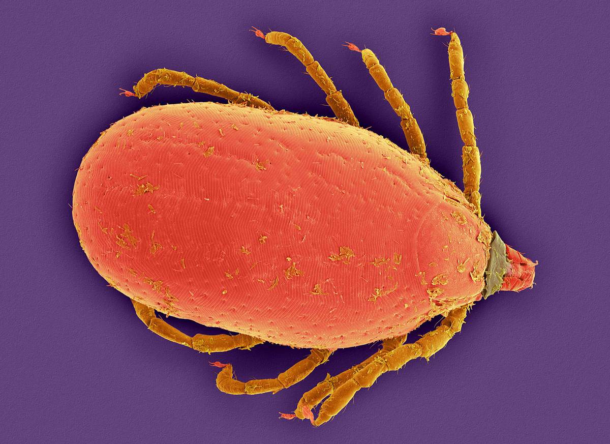 צילום מיקרוסקופ אלקטרונים של קרציית כלב חומה עם בטן מלאה דם | Dennis Kunkel Microscopy, SPL