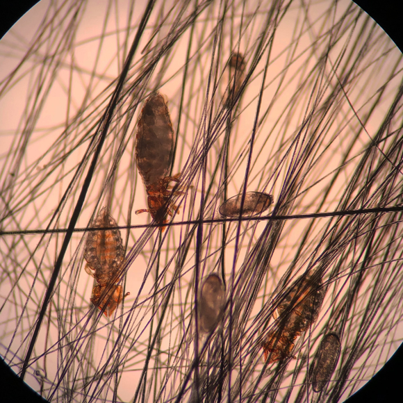 צילום מקרוב של כיני ראש | Shutterstock