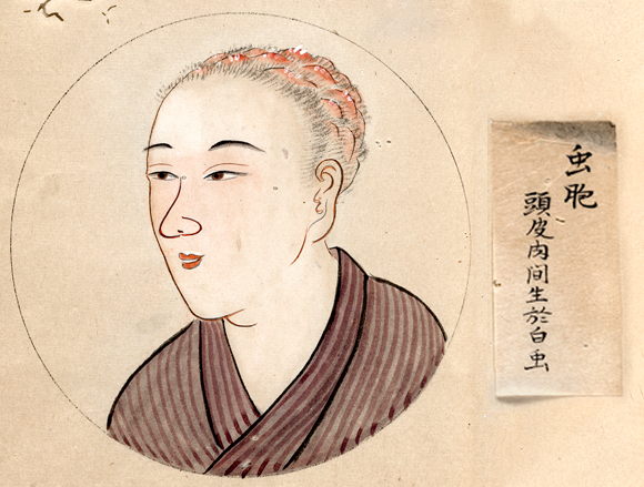 מטופלת בכינים, יפן, המאה ה-19 | SPL