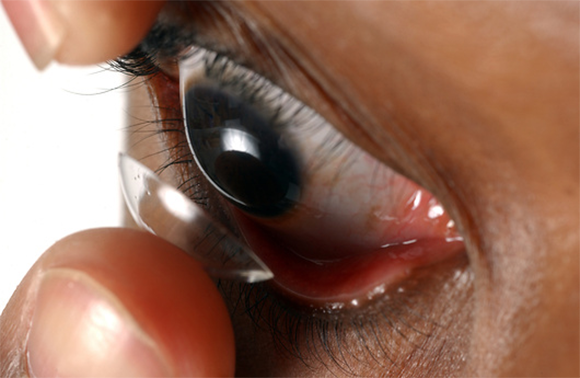 הכנסת עדשת מגע לעין | צילום: NEWSCAST / UNIVERSAL IMAGES GROUP / SCIENCE PHOTO LIBRARY