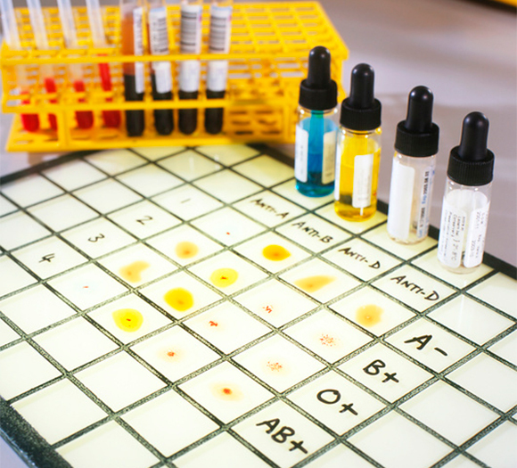 בדיקה לקביעת סוג דם | מקור: Tek Image / Science Photo Library