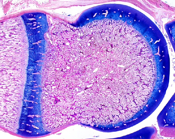 תמונה מיקרוסקופית שלעצם מתפתחת. הפס הכחול למטה נקרא "לוחית גדילה" ובו נמצאי תאי הסחוס המתפתחים שאת מקומם תופסת בהמשך רקמת עצם. מקור: spl