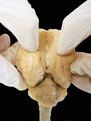 الفصّان الدماغيان للخروف | الصورة مأخوذة من ويكيبيديا; أُنشئت من قبل aaronbflickr