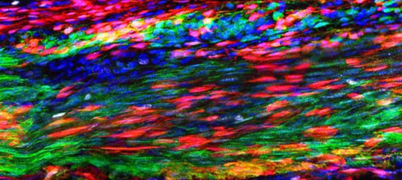 תאי גזע גידיים (מסומנים באדום) בגיד של עכבר | צילום: Tyler harvey, מכון קרנגי
