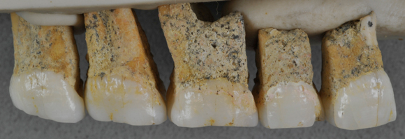 חלק מהשיניים שנמצאו במערת קלאו | Callao Cave Archaeology Project