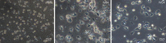 שלוש מהתרביות ששימשו במחקר, בעלות צבע וצורה שונים | מתוך המאמר Kawamura et al., Marine Biotechnology