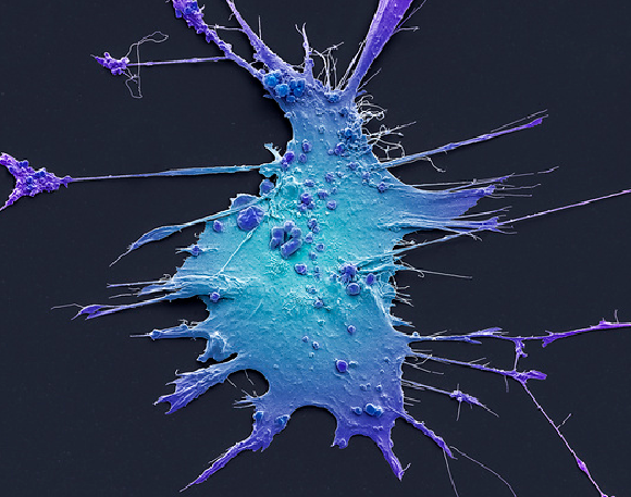 דווקא התאים של הכבד הם שמעוררים את התא הסרטני. צילום צבוע במיקרוסקופ אלקטרונים סורק של תא HSC | מקור: STEVE GSCHMEISSNER / SCIENCE PHOTO LIBRARY