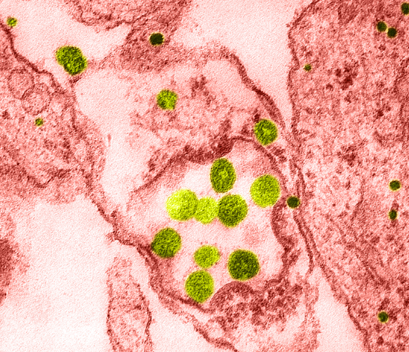 נגיפי קורונה של אדם ממין HCoV-229E (ירוק), צילום צבוע במיקרוסקופ אלקטרונים | מקור: SCIENCE SOURCE / SCIENCE PHOTO LIBRARY