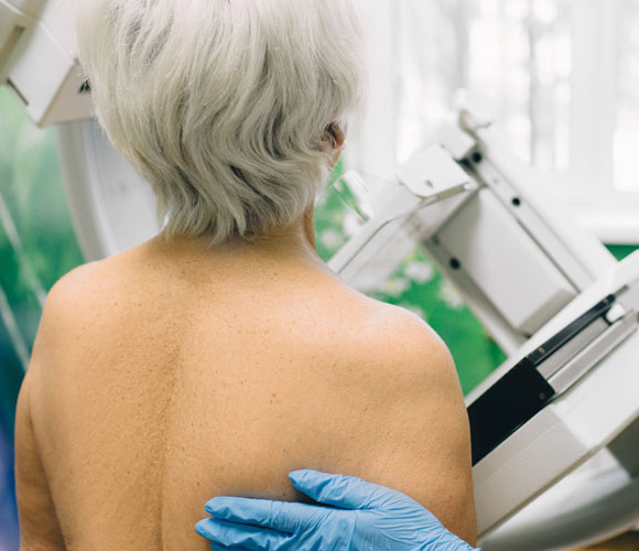 בדיקת ממוגרפיה