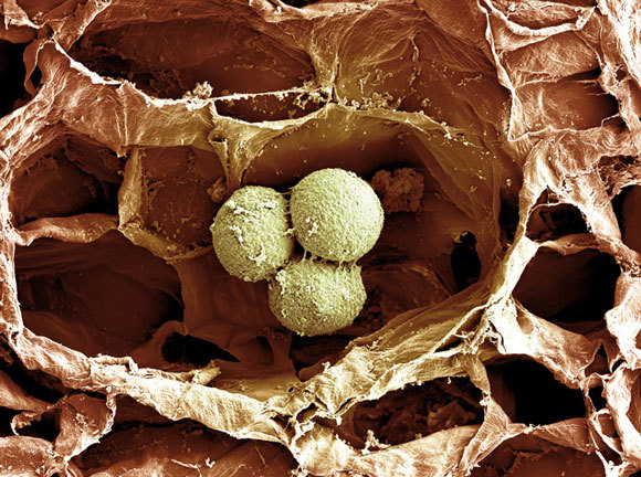 גרנולות עמילן בצילום מוגדל פי 550 | מקור: NANO CREATIVE / SCIENCE SOURCE / SCIENCE PHOTO LIBRARY