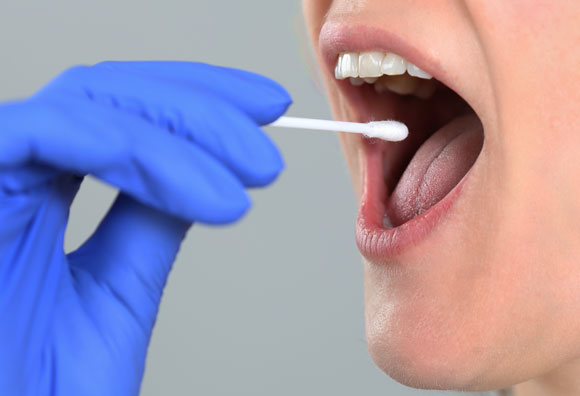 Im Bild: Ein Wattestäbchen, das zur DNA-Probe benutzt wird. Quelle: Shuttersto