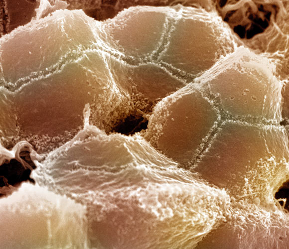 צילום מיקרוסקופ אלקטרונים סורק של כבד עכבר | מקור: Science Source / Science Photo Library