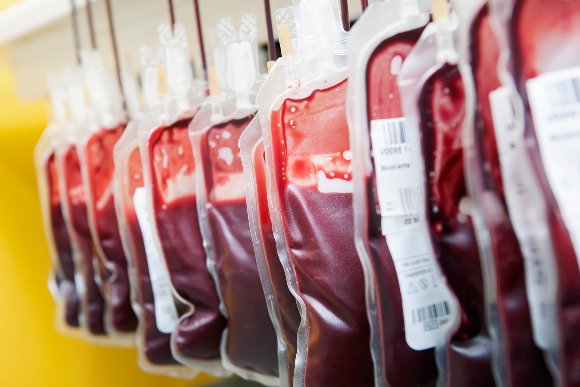 נות דם | צילום: THOMAS FREDBERG / SCIENCE PHOTO LIBRARY