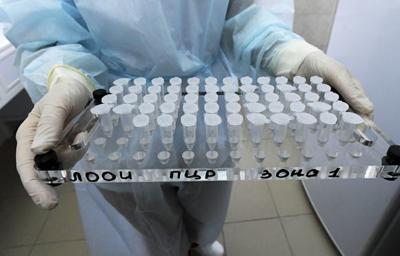 דרך למכשיר ה-PCR - דגימות שנאספו מנבדקים ברוסיה במהלך העיבוד | צילום: SPUTNIK / SCIENCE PHOTO LIBRARY