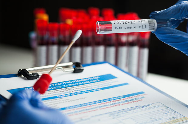 היכולת לזהות את הווריאנט ב-PCR מאפשרת מיפוי של התפשטותו באוכלוסייה. מטוש לבדיקת קורונה | צילום: Cryptographer, Shutterstock