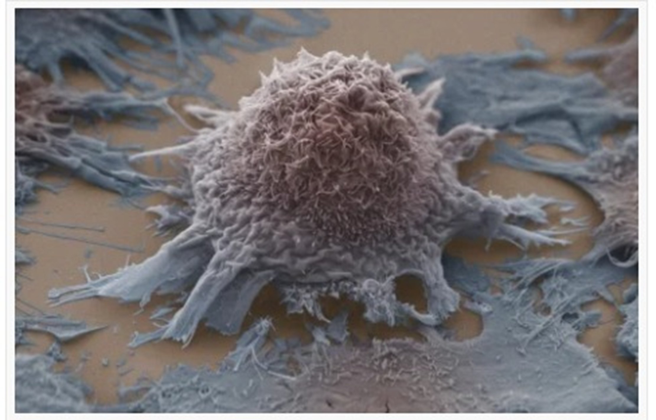 תמונה: תא סרטן ריאה שגדל בתרבית. צילום: Anne Weston, Francis Crick Institute, CC-BY.