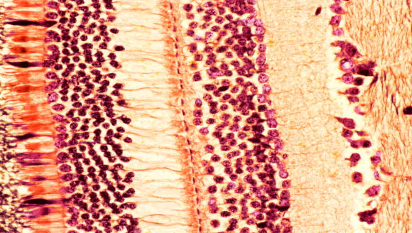 מבנה הרשתית: התאים קולטי האור משמאל, בוורוד וכתום, ומאחוריהם שכבות של תאי עצבים (צהוב) | צילום במיקרוסקופ: STEVE GSCHMEISSNER / SCIENCE PHOTO LIBRARY