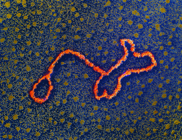 צילום במיקרוסקופ אלקטרונים של טרנספוזון ב-DNA של אדם | מקור: PROFESSOR STANLEY COHEN / SCIENCE PHOTO LIBRARY