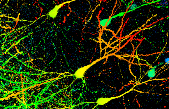 תאי עצב של עכבר מסומנים בחלבון הירוק הזוהר. צילום במיקרוסקופ: DR GOPAL MURTI / SCIENCE PHOTO LIBRARY