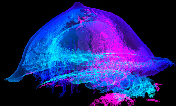 שתל בחזה | צילום: Science Photo Library