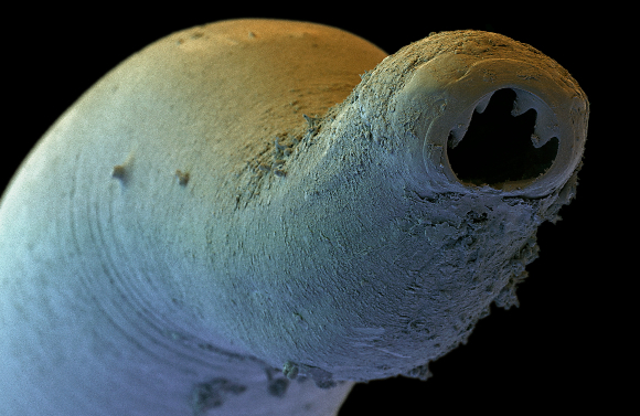 צילום במיקרוסקופ אלקטרונים של תולעת הקרס ששימשה השראה לחוקרים | מקור: DAVID SCHARF / SCIENCE PHOTO LIBRARY