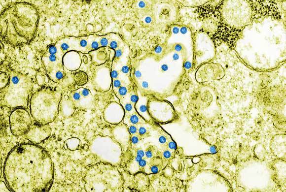 צילום צבוע במיקרוסקופ אלקטרונים | מקור: CDC / SCIENCE PHOTO LIBRARY