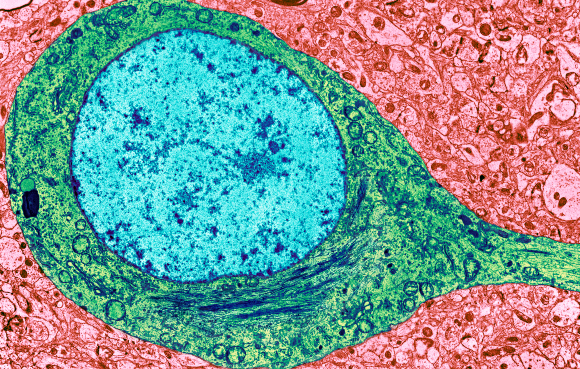 צילום צבוע של מיקרוסקופ אלקטרונים | מקור: THOMAS DEERINCK, NCMIR / SCIENCE PHOTO LIBRARY