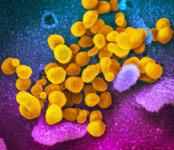 תמונת מיקרוסקופ של חלקיקי נגיף הקורונה החדש | NIAID-RML, National Institutes of Health, SPL