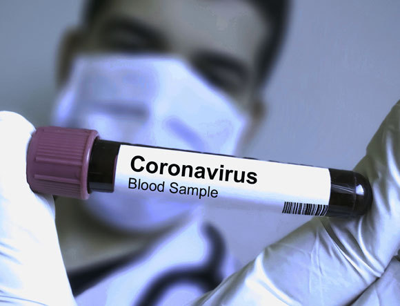 מבחנה עם דם נגוע | אילוסטרציה: Soni's, Shutterstock