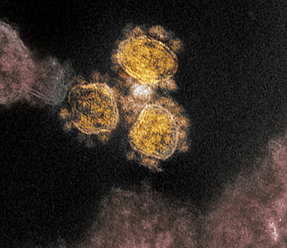 שלושה נגיפי SARS-CoV-2 מגיחים מתוך תא, תמונת מיקרוסקופ אלקטרונים | קרדיט: NIAID-RML