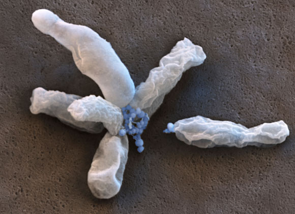 צילום במיקרוסקופ אלקטרונים של חיידקים מחמצני ברזל | מקור: Science Photo Library