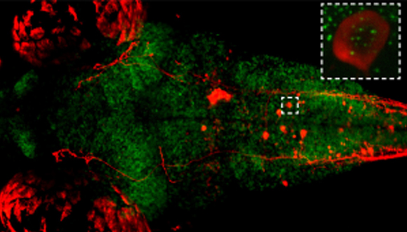 הדמיה של פעילות הכרומוזומים (ירוק) בתוך תא עצב יחיד (אדום, מוגדל בתיבה המקווקוות) | מקור: מעבדת ליאור אפלבום