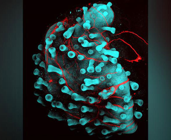  תרבית של תאי עור: הבליטות הם זקיקי שיער שמתחילים להתפתח, והחוטים האדומים הם עצבים | Jiyoon Lee, Boston Children's Hospital