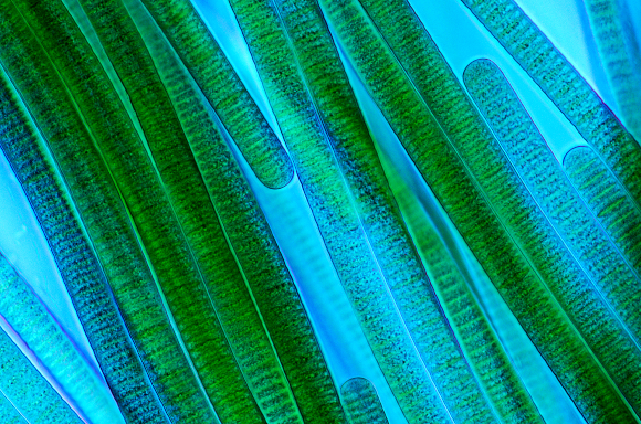 צילום במיקרוסקופ: MAREK MIS / SCIENCE PHOTO LIBRARY