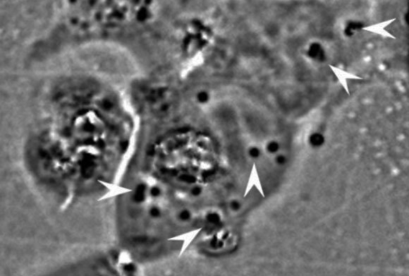 תמונת מיקרוסקופ פאזות של צבירי חלבונים שנלקחו מדיונונים, הנראים כעיגולים שחורים, בתוך תאי אדם | Atouli Chatterjee / UC