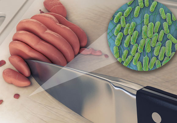 אילוסטרציה של בשר עוף וקרש חיתוך מזוהמים בסלמונלה | איור: Science Picture Co / SPL