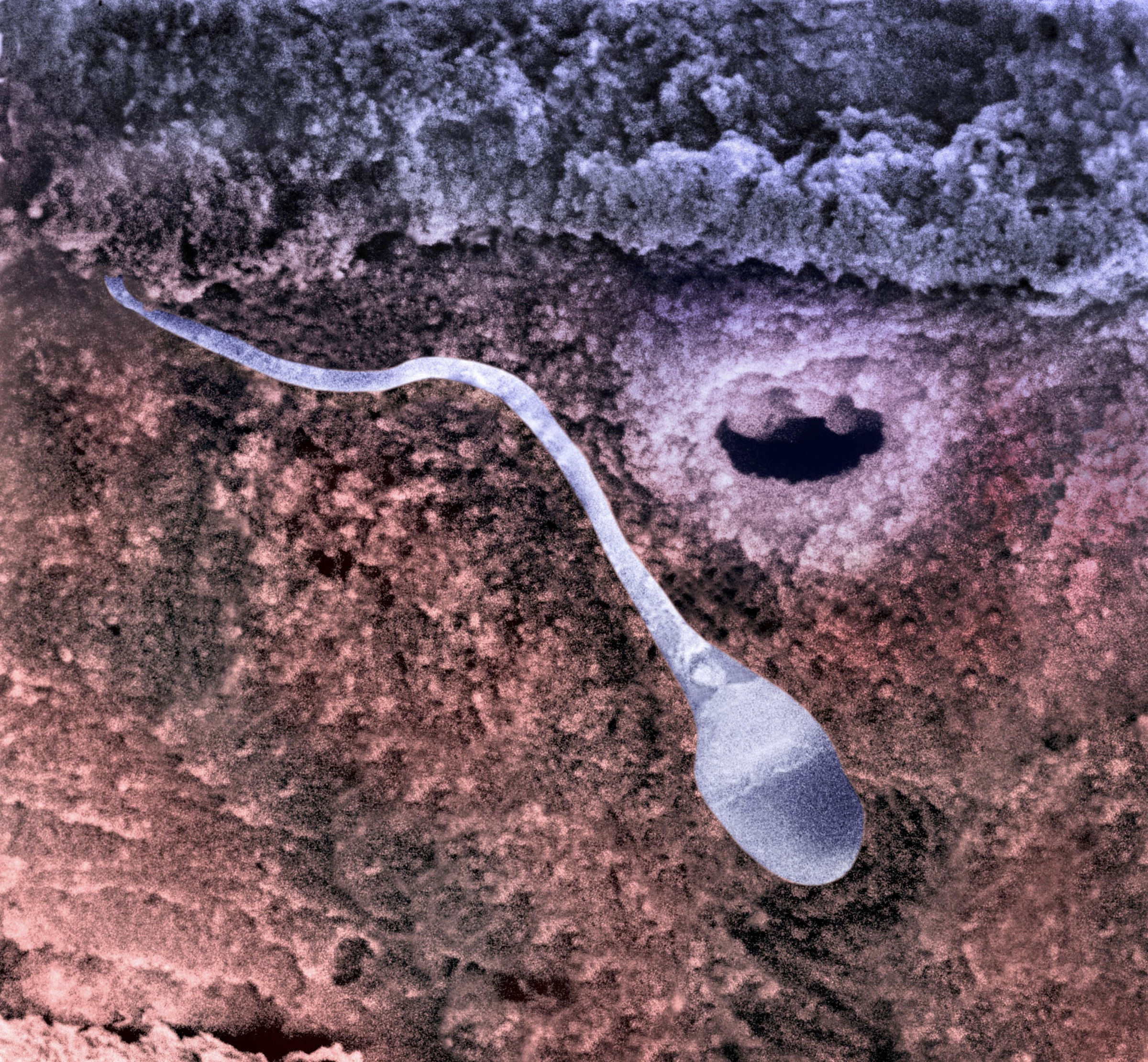 תא זרע כפי שנראה במבט מלמעלה במיקרוסקופ SPL