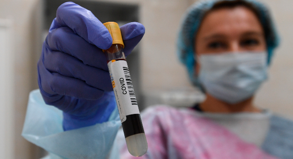 בדיקת דם לזיהוי קורונה | צילום: SPUTNIK / SCIENCE PHOTO LIBRARY