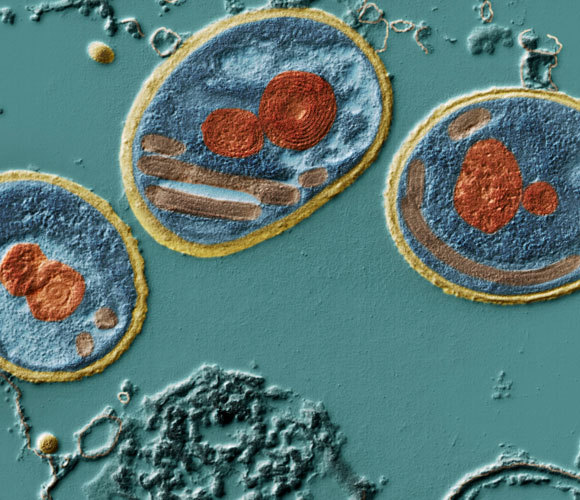 הפטריה החד-תאית מיקרוספורידיה | Eye of Science, SPL