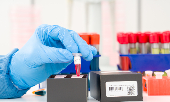 בדיקות דם של חולי קורונה | צילום אילוסטרציה: science photo, Shutterstock