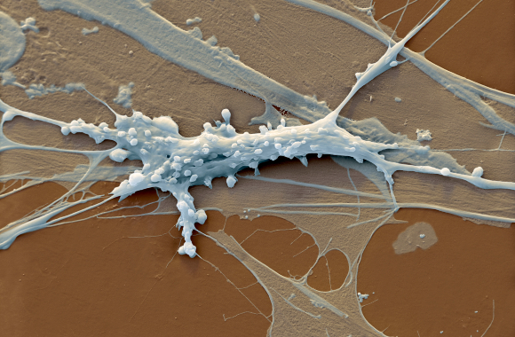 תא פיברובלסט | צילום במיקרוסקופ אלקטרונים סורק: EYE OF SCIENCE / SCIENCE PHOTO LIBRARY